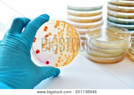 Colonies of bacteria in petri dish (MacConkey agar)