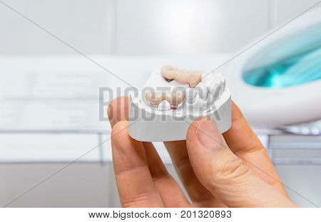Technical shots of model on a dental prothetic laboratory. Close up.