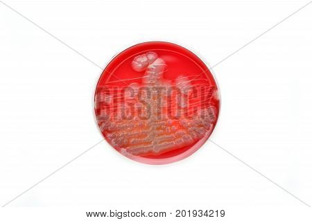 Colonies of bacteria in culture medium plate