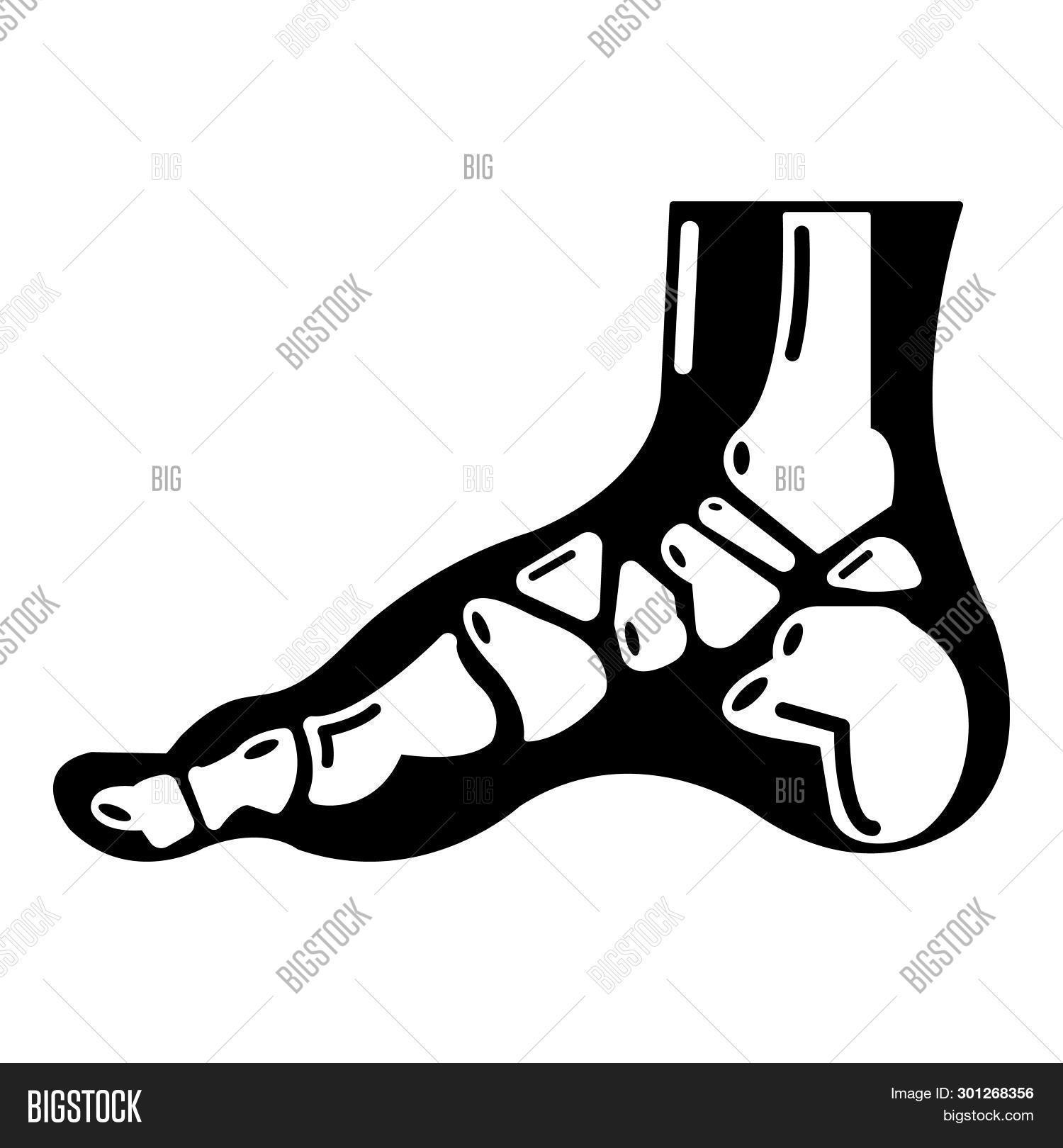 Xray Foot Icon. Simple Image &amp; Photo (Free Trial) | Bigstock