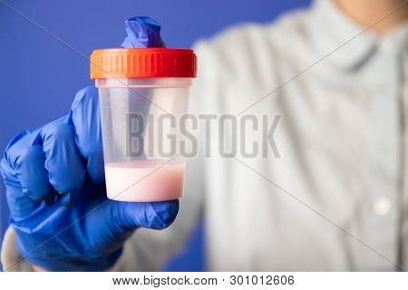 Test Tube With The Analysis Of Sperm Leaves