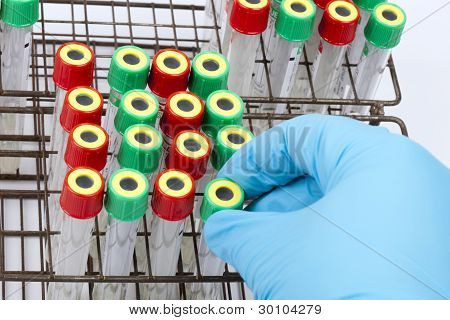 provette di sangue