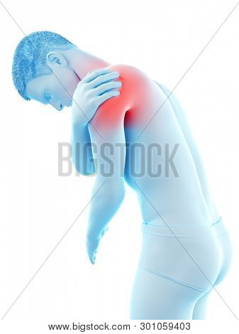 3d rendered medically accurate illustration of a painful elbow