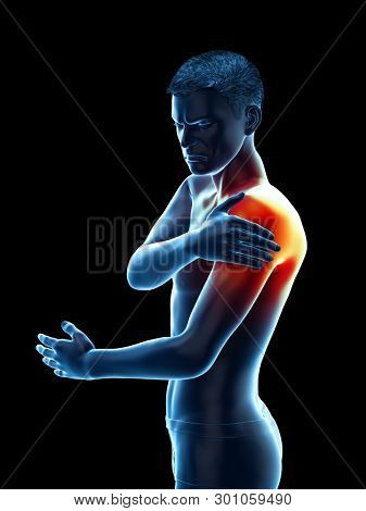 3d rendered medically accurate illustration of a painful elbow