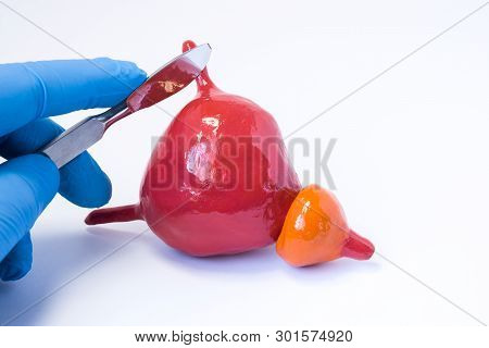 Surgery And Operations On Ureters Idea Photo. Doctor Surgeon Or Urologist Holding A Scalpel And Puts