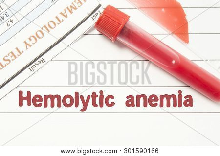 Diagnosis Hemolytic Anemia. Notepad With Text Labels Hemolytic Anemia, Laboratory Test Tubes For The