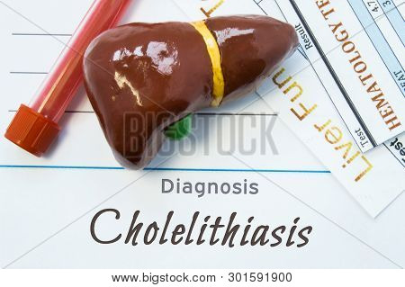 Cholelithiasis Diagnosis. Sheet Of Paper Or Book With Inscription Cholelithiasis Lie Next To Stethos