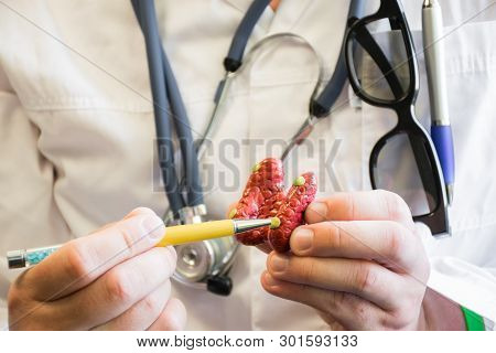 Doctor In White Lab Coat Points On Parathyroid Glands In Anatomic Model Of Thyroid Gland. Concept Ph