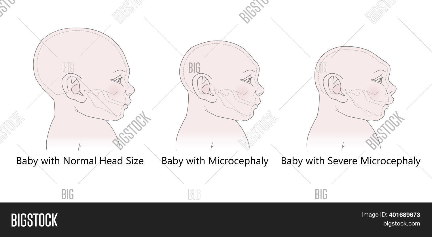 Comparative Anatomical Image & Photo (Free Trial) | Bigstock