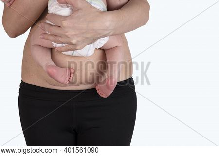 Closeup Of Woman Belly With A Scar From A Cesarean Section. Woman With Baby On Her Hand