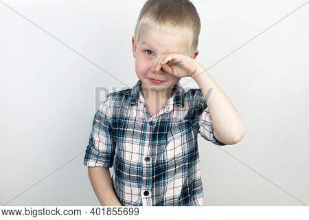 An Ophthalmologist Examines A Boy Who Complains Of Burning And Pain In His Eyes. Eye Fatigue From A