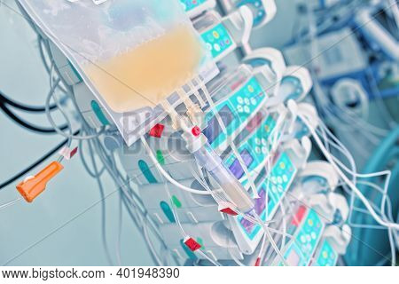 Intravenous Drip And Electronic Devices In The Icu As A Concept Of An Integrated Approach To Treatme