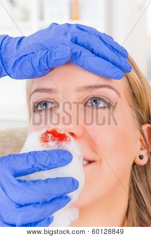 Nurse helping young woman with bleeding nose