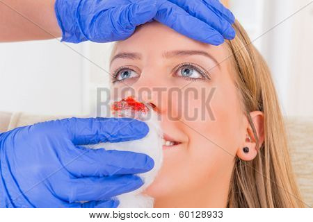 Nurse helping young woman with bleeding nose