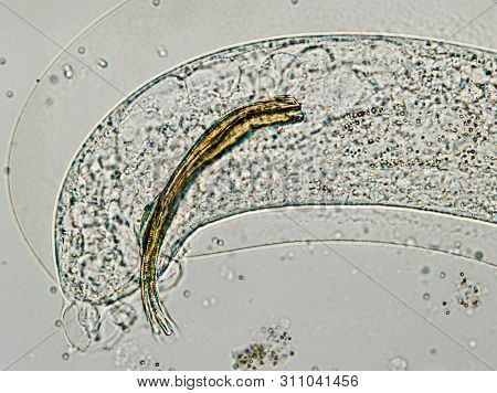 The Tail Of Aelurostrongylus Abstrusus, Cat Lungworm Under The Microscope