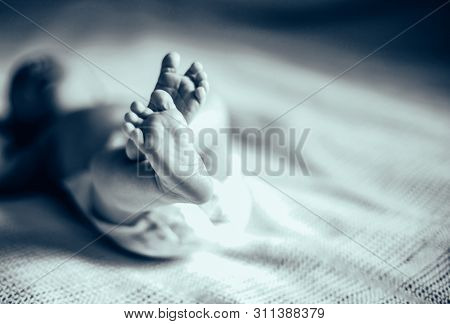 Black-and-white Photo.health Concept - Closeup Of Legs Of A Newb