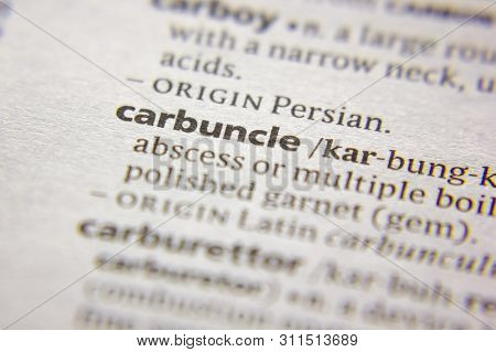 Word Or Phrase Carbuncle In A Dictionary