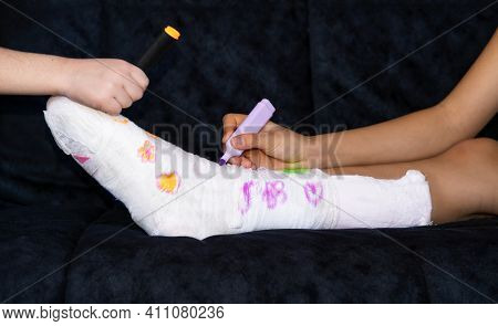 Broken Leg. Bone Damage. Children Paint Plaster. Girl Boy Paint A White Bandage On His Leg With Colo