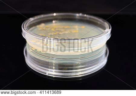 A Petri Dish With Common Yeast And Bacteria Colonies