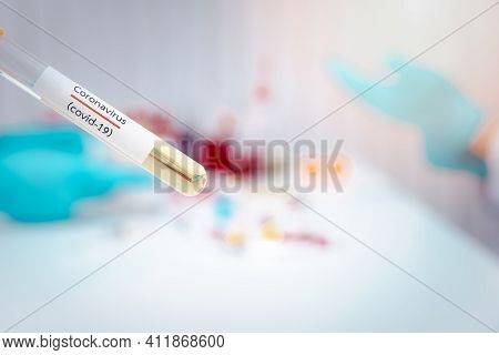 Test Tubes Containing Plasma Extracted From The Blood Of People Who Had Been Ill With Coronavirus, C