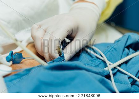 Patient Do Tracheostomy And Ventilator In Hospital