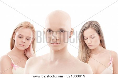 Portrait of young hairless woman. 
This is a free image, part of a charity project. Models and the staff worked for free to support breast cancer awereness campaigns worldwide.