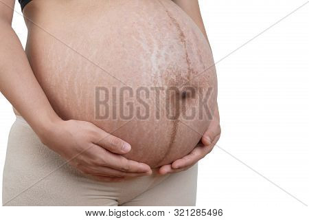 Belly Of A Pregnant Woman With Stretch Marks On White Background. With Clipping Path