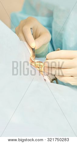 Ophthalmology Laser Microscope Operation. Doctor In Clinic. Patient Eye Treatment. Myopia And Catara