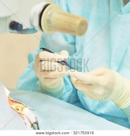 Ophthalmology Laser Microscope Operation. Doctor In Clinic. Patient Eye Treatment. Myopia And Catara