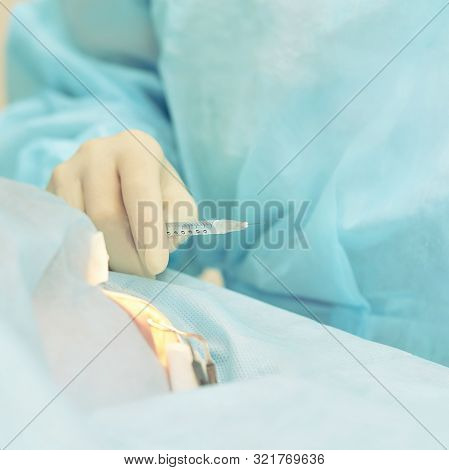 Ophthalmology Laser Microscope Operation. Doctor In Clinic. Patient Eye Treatment. Myopia And Catara