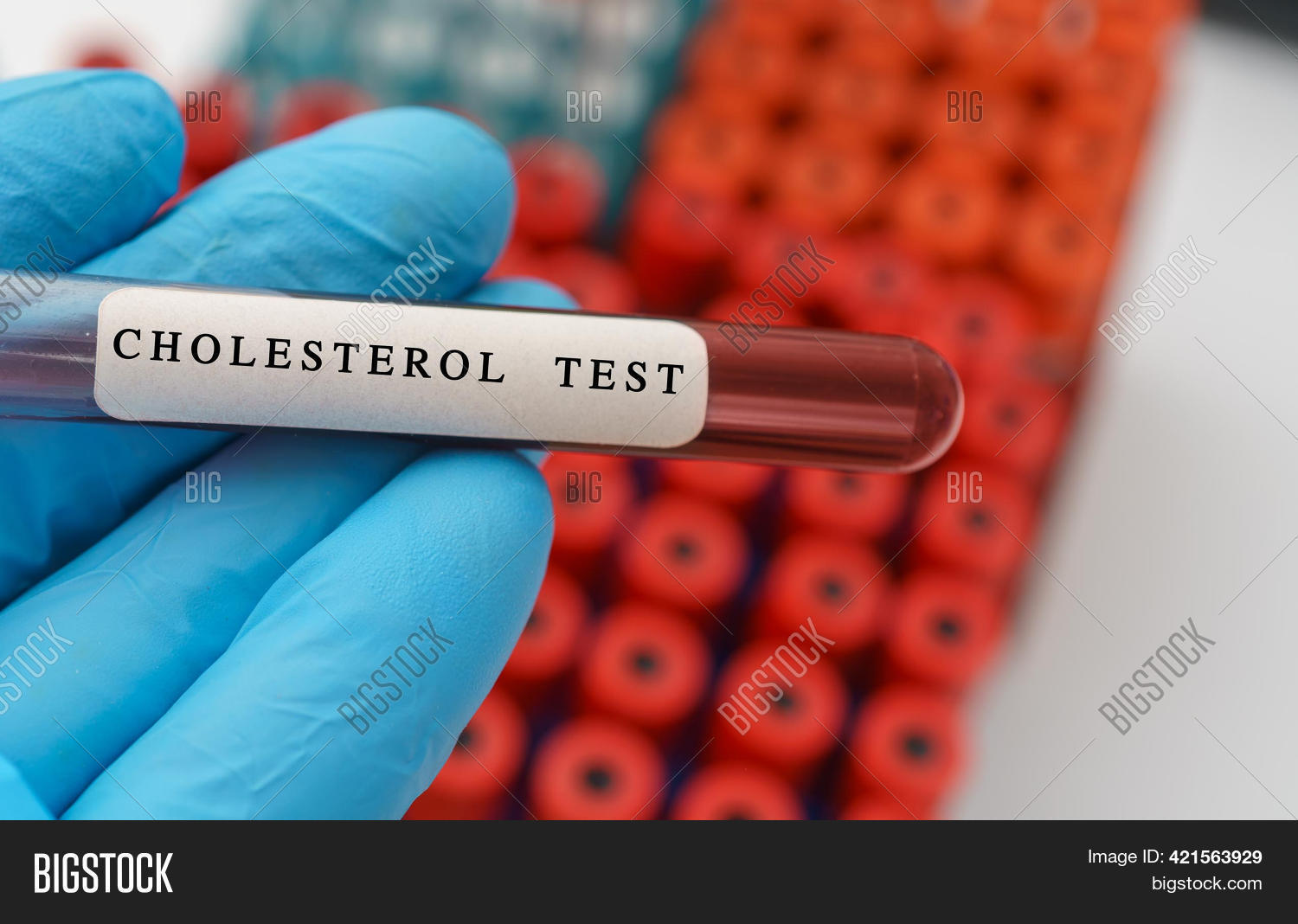 Cholesterol Test Image & Photo (Free Trial) Bigstock
