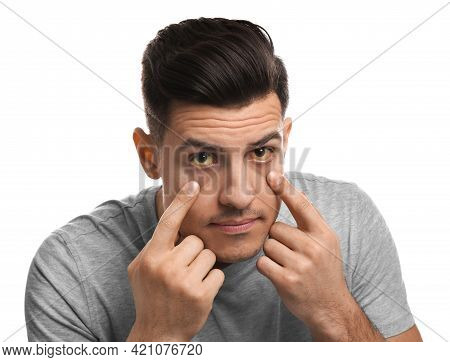 Man Checking His Health Condition On White Background. Yellow Eyes As Symptom Of Problems With Liver
