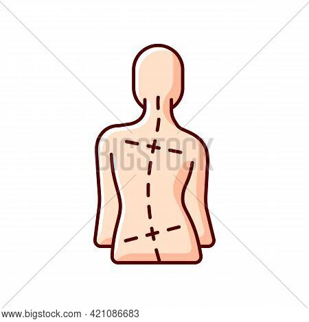Uneven Hips And Shoulders Rgb Color Icon. Abnormal Curve In Spine. Worsening Scoliosis. Muscular Imb