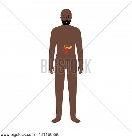 Pain, Inflammation In Spleen. Cirrhosis, Leukemia Concept. Adult Black Man Anatomy Poster. Ache In M