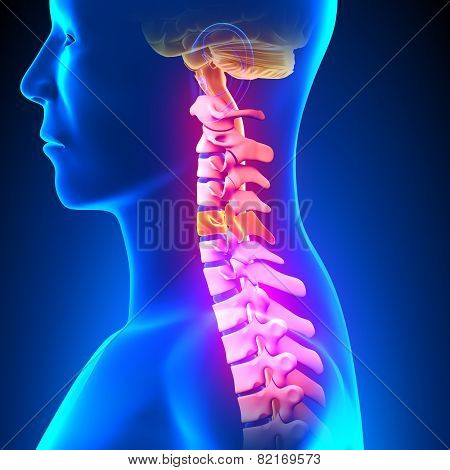 C5 Disc - Cervical Spine
