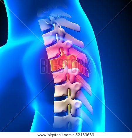 T3 Disc - Thoracic Spine Anatomy