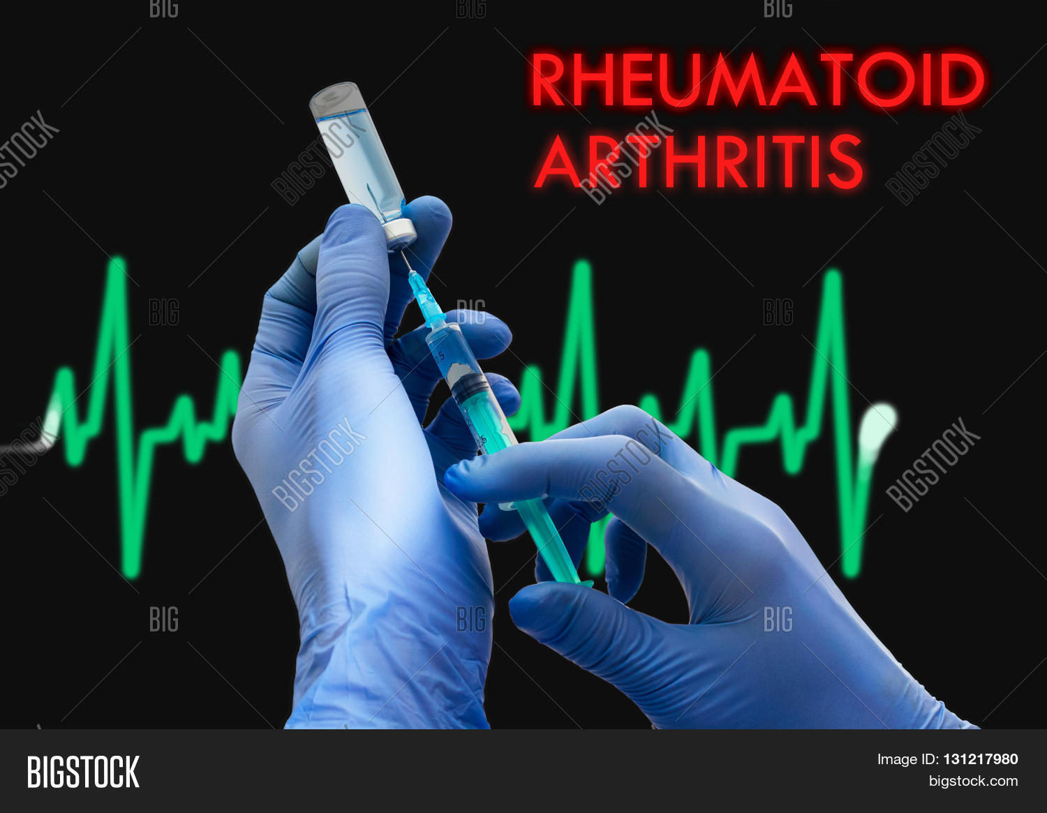 Treatment Rheumatoid Image & Photo (Free Trial) | Bigstock