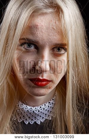 pimply skin blond girl on black background