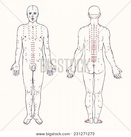Acupuncture Scheme With Red Points, Hand Drawn Doodle, Sketch In Pop Art Style, Black And White Medi