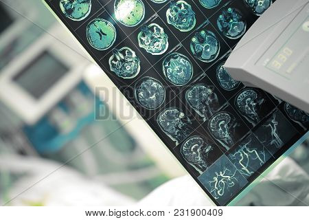 Mri Of Human Head On The Background Of Hospital Equipment.