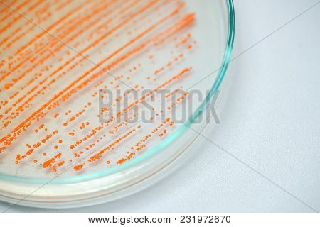 Colony Of Bacteria In Culture Medium Plate, Microbiology.