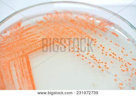 Colony Of Bacteria In Culture Medium Plate, Microbiology.