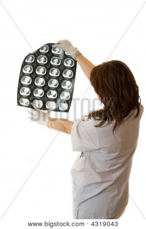 Doktor žena při pohledu na RTG plic