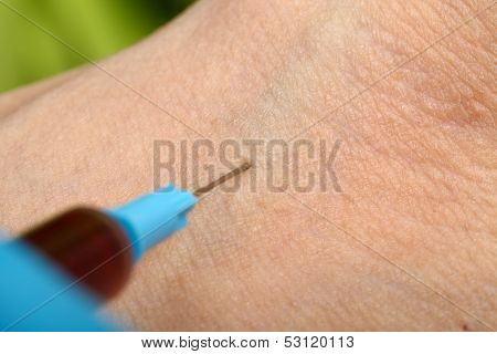 Blood Sampling With Syringe And Needle