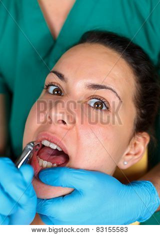 Dental Extraction