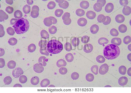 Pmn With Toxic Granule