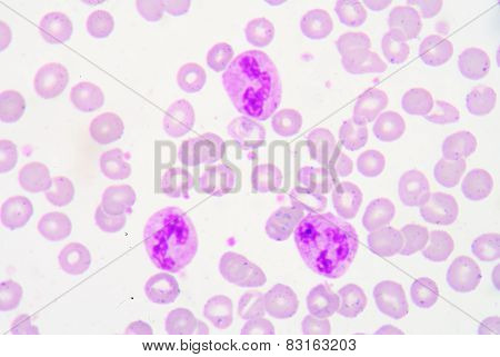 Pmn With Toxic Granule