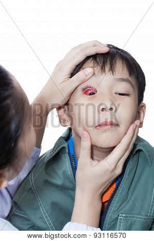 Pinkeye (conjunctivitis) Infection On A Boy, Doctor Check Up Eye Patient,isolated On White