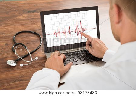 Doctor Looking At Heartbeat Cardiogram