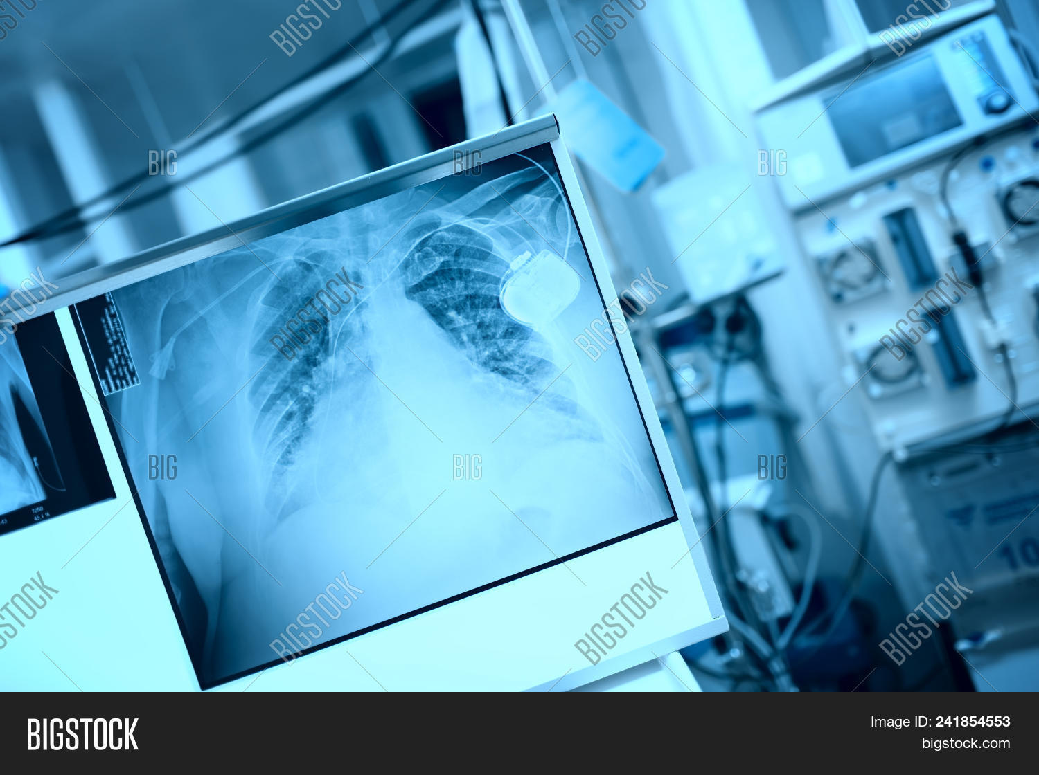 X-ray Film On Light Image & Photo (Free Trial) | Bigstock